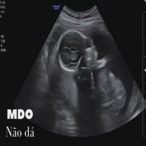MDO Menino de Ouro